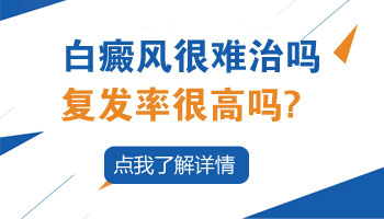 白癜风复发几率很高吗 有没有治好不复发的