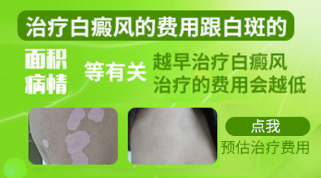 石家庄远大308激光如何收费的