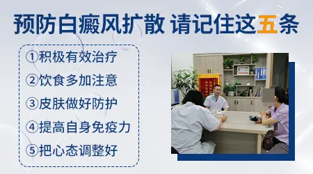 白癜风扩散前有没有征兆