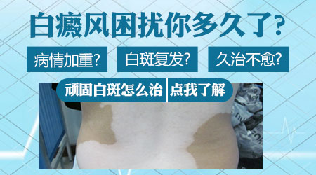 胸部白癜风的治疗方法有哪些
