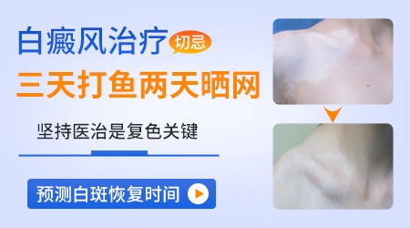 中医艾灸治白癜风穴位