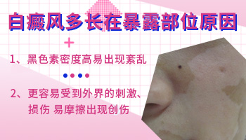 为什么年纪大了长白癜风