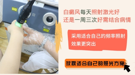 308激光照射白癜风一周照几次