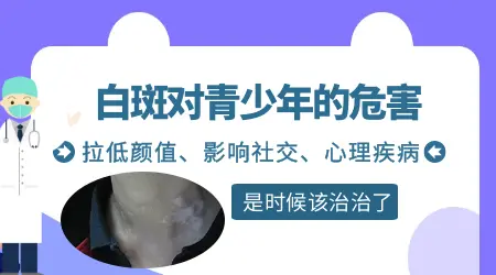 白癜风的危害是什么