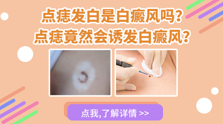 点痣留下的白点图片