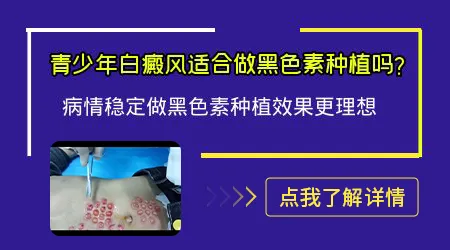 黑色素细胞移植和表皮移植有什么区别