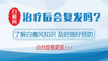 白癜风如果治好后还会复发吗