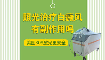 白癜风进展期可以照光吗