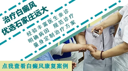 白斑在伍德灯下显示淡蓝色