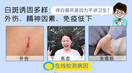 白癜疯的原因有哪些？
