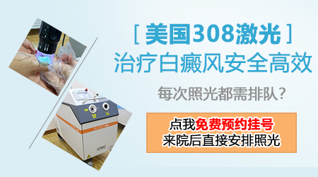 白癜风一次照几分钟