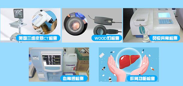 15岁男孩身上白斑做过皮肤镜像是白癜风