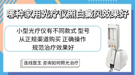 腿部白癜风在家自己照窄谱UVB安全吗