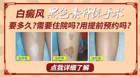 腋下很小一块瓷白色白癜风能种植或者植皮吗