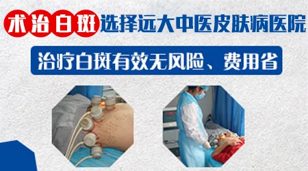 白癜风植皮手术后自己可以拆吗