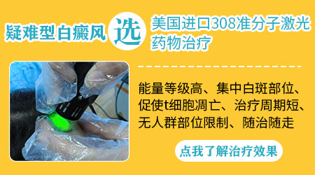 嘴唇白癜风图片 嘴唇白斑怎么治