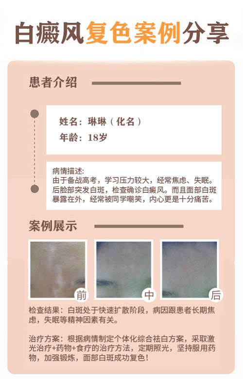 皮肤白斑可不可以喝羊奶