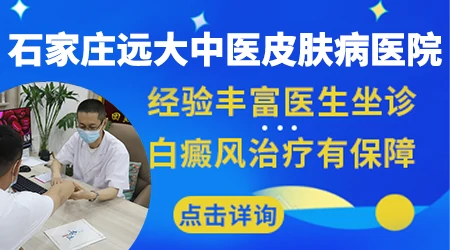 石家庄哪里有专门看白癜风好的医生