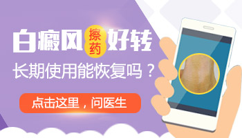 白癜风要吃多久的药