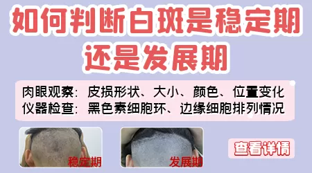 白癜风种植手术后恢复的过程