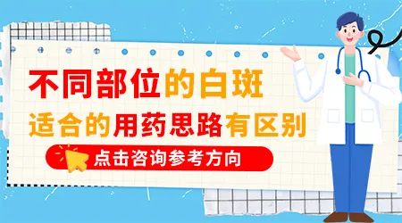 不同部位的白癜风用药有什么区别