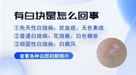 肚脐旁边长了个浅色斑不痛不痒是什么情况