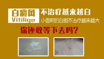 身体无缘无故出现小白点