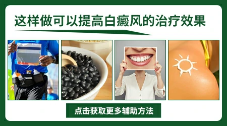 308激光和窄谱UVB选哪个照面部白癜风好