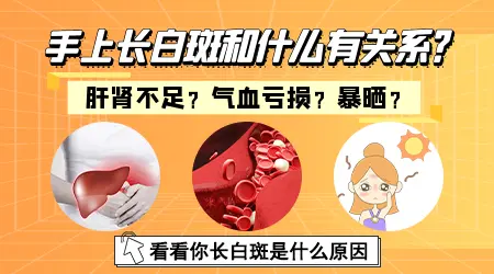 补骨脂酊对手部白癜风有效果吗