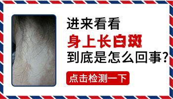 去美容院护理后面部出现白斑怎么回事