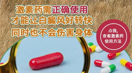 外用激素药膏治疗白癜风效果怎么样