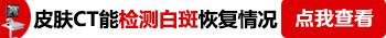 白癜风患者一周可以照一次308激光吗