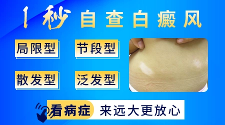 孩子缺锌长白斑图片
