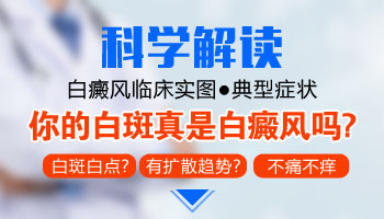 邢台脸部白癜风症状是什么