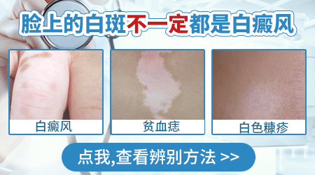 脸上突然有一小块白斑怎么回事