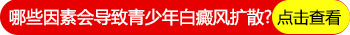 青少年双手散发型白斑怎么回事