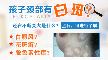 宝宝脖子上ZUI近长了一小块白斑面积在增大