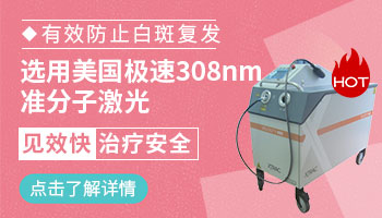 你还在害怕白癜风复发吗 如何治疗白癜风不复发