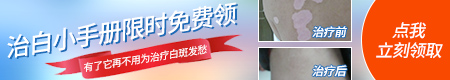 早期白斑图 白斑治疗什么方法好