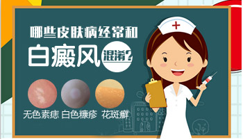 什么是白癜风 白癜风的表现症状有哪些