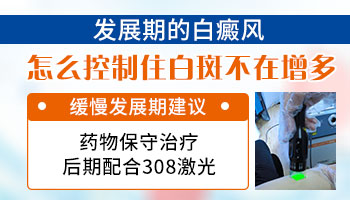 治疗扩散期的白癜风多久能控制住