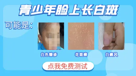 青年头皮上有白斑是什么原因