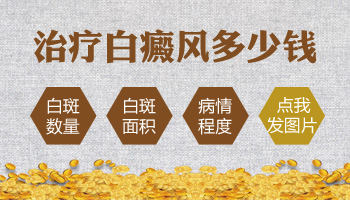 白癜风的治疗费用总共是多少