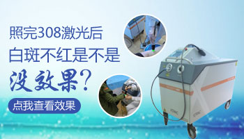 白癜风第一次做308白色部位变红正常吗