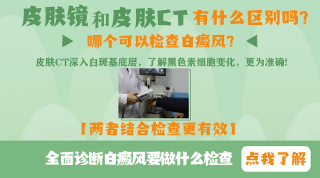 皮肤镜和皮肤ct有什么区别吗