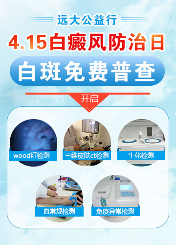 手上白点图片 白点是白癜风吗