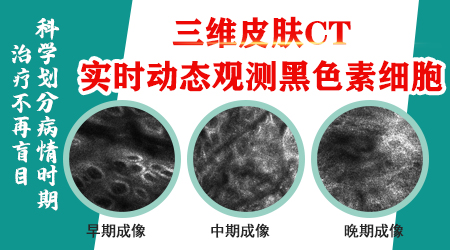白癜风患者如何快速补充皮肤中的黑色素