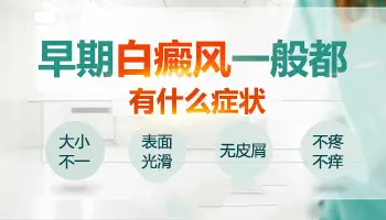 判断白癜风的几个方法 【白癜风早期的症状】