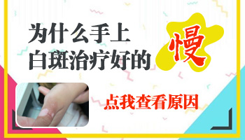为何面部白癜风比手好治