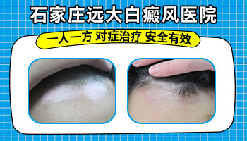 胸前出现白色斑点状是怎么回事